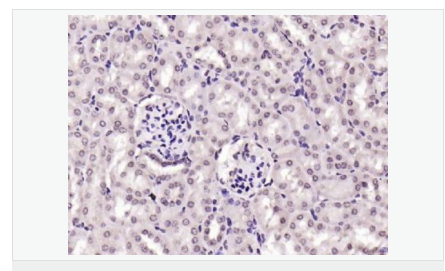 6052bc1e1e42c.png image.png