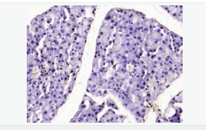 60544cc5c674d.png image.png