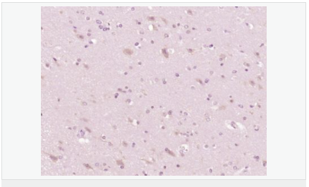 60582cf155aa0.png image.png