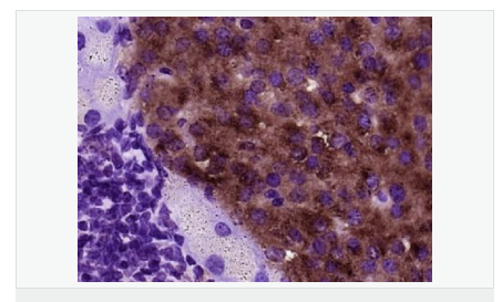 60594087e1110.png image.png