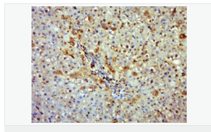 60595ce60d364.png image.png