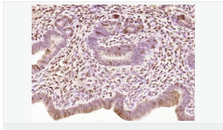 60595f5079dab.png image.png