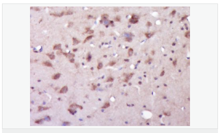 6064171e037dc.png image.png