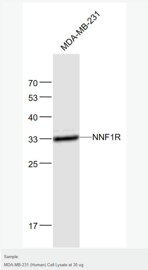 6066bd4f306a0.png image.png