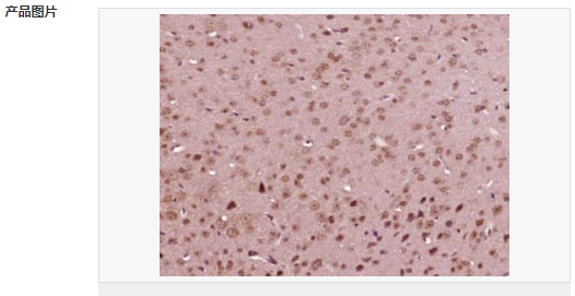 6066c58c0b7d2.png image.png