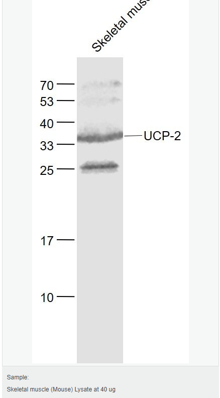 606bcd085199e.png image.png