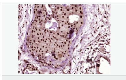 607649dde1ccd.png image.png